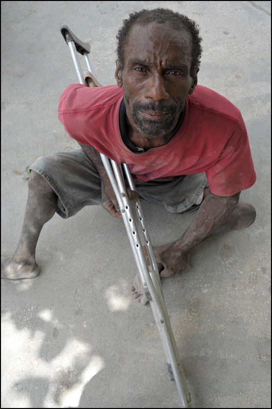 One man in Port-au-Prince in two images from two years: 2012 and 2017 (no shirt).